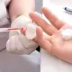 Neden genel analiz için kan parmak ucundan alınır?
