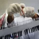 Россиянинг коронавирусга қарши вакцинасининг ҳужжатлардаги асл ҳолати ошкор бўлди
