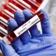 O‘zbekistonda koronavirus bilan kunlik kasallanish holati yana 600 kishidan kamaydi