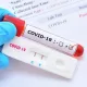 Ўзбекистонда коронавирус қайд этилганлар сони 39 641 нафарга етди