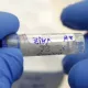 Мексикада Зика вирусига чалинганлар сони 1,3 минг кишига етди
