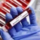 O‘zbekistonda koronavirus bilan kunlik kasallanish holati yana 600 kishidan kamaydi