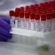 Bir kun ichida Toshkent viloyatidagi 19ta tuman va shaharda koronavirus aniqlandi