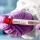 O‘zbekistonda yangi antirekord — bir sutkada 1037 kishida koronavirus aniqlandi