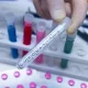 O‘zbekiston fuqarolari orasida koronavirus infeksiyasi qayd etilmagani ma’lum qilindi