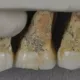 Филиппинда янги турдаги одам қолдиқлари топилди (фото, видео)
