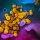 So‘lak va plastik yuzasida: koronavirus qancha yashaydi?