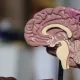 Олимлар эрта инсултнинг сирли сабабини аниқлади