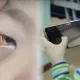 Telefon sabab bolalar ko‘zida sariq parda o‘syaptimi?