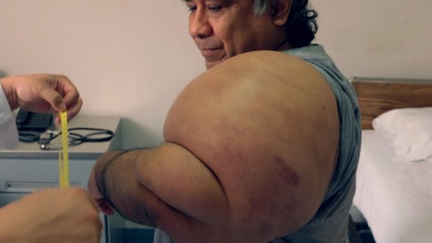 Ғаввос сув сиртига кескин кўтарилгач 30 килограммга оғирлашиб кетди