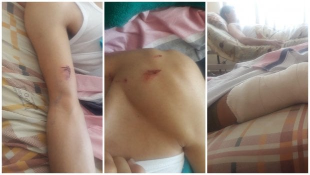 Toshkentda 34 yoshli tadbirkor ayovsiz tarzda kaltaklab ketildi (foto, video)