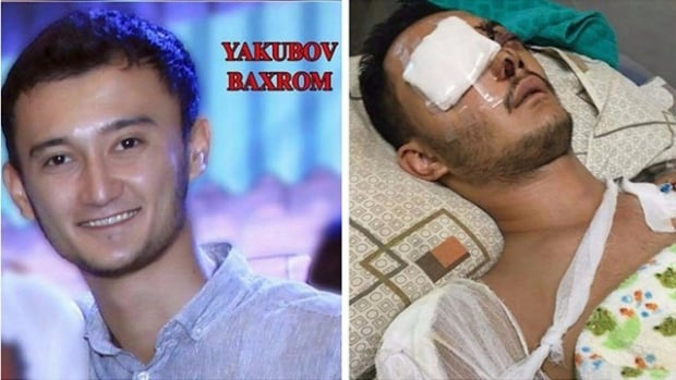 Аттракциондан йиқилиб жароҳат олган актёрга 98 млн. сўм моддий зарар ундириб берилди