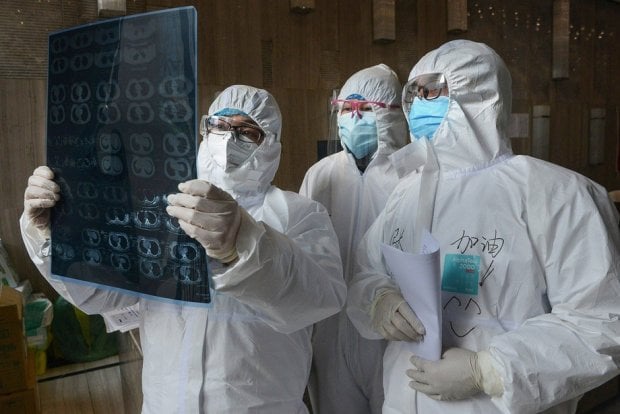 Хитойлик шифокорлар коронавирусни аёллар эркакларга қараганда осонроқ енгишини аниқлашди