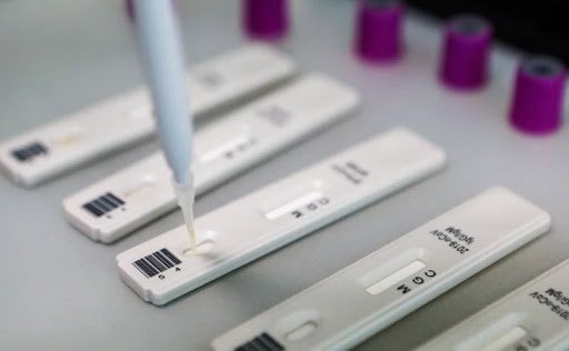 Ўзбекистонда коронавирусга иммунитетни аниқлаш тестлари ўтказилиши бошланди