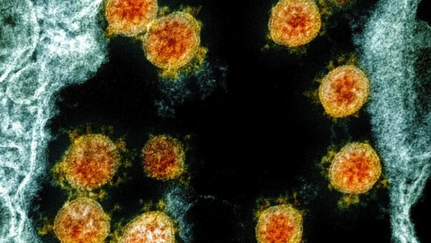 Коронавируснинг осон тарқалишига имконият яратувчи иқлим шароити маълум қилинди